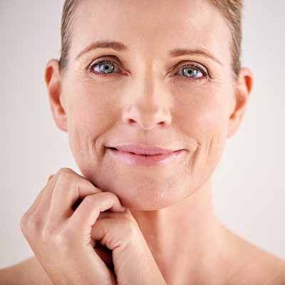 Chemical Peel Model