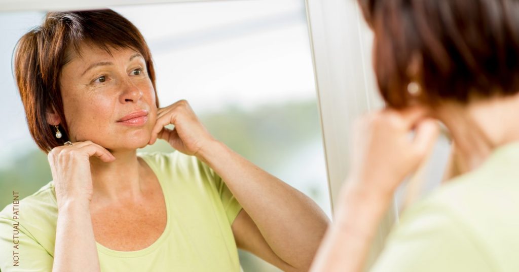 Woman pondering if it's time for her to get a facelift (NOT ACTUAL PATIENT)