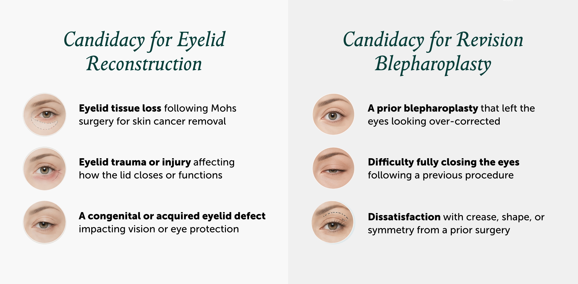 Infographic outlining who may be a candidate for eyelid reconstruction vs. revision blepharoplasty, with eye illustrations